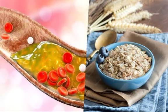 மாத்திரை வேண்டாம்! கெட்ட கொழுப்பை கரைக்க 7 மேஜிக் வழிகள்!