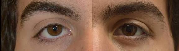 ஆண் பிறவி !