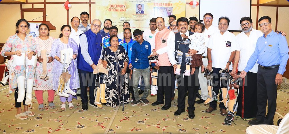 கோவையில் 100 மாற்றுத்திறனாளி குழந்தைகளுக்கு செயற்கை கால்கள்