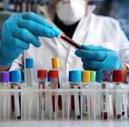 ரூ.35,400 சம்பளத்தில் தமிழக அரசு மருத்துவமனைகளில் லேப் டெக்னீசியன் பணி