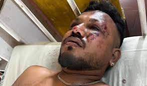 அகமதாபாத் விமான விபத்தில் தப்பியவருக்கு மனநல சிகிச்சை - உறவினர்கள் கூறியது என்ன?