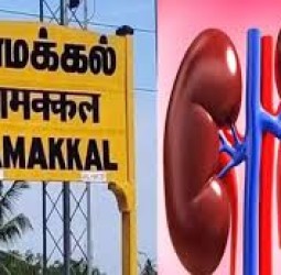 நாமக்கல் கிட்னி விற்பனை புகார்: தானமாக வழங்கியவர், பெற்றவர்களிடம் சிறப்பு குழு விசாரணை