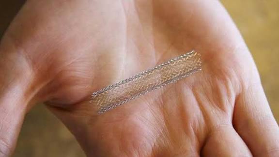 இந்​தி​யா​வில் தயாரிக்​கப்​பட்ட புதிய தலை​முறை இதய ஸ்டென்ட்​டுக்கு உலகளா​விய அங்​கீ​காரம் கிடைத்​துள்​ளது