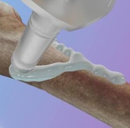 முறிந்த எலும்புகளை மூன்றே நிமிடத்தில் ஒட்ட வைக்கும் பசை: சீன விஞ்ஞானிகள் கண்டுபிடிப்பு