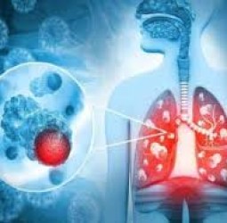 இந்தாண்டு இறுதிக்குள் புதிதாக 1 லட்சம் பேருக்கு புற்றுநோய் : தேசிய சுகாதார திட்ட அதிகாரி தகவல்