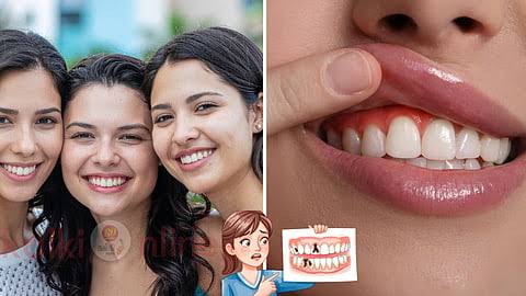 ஒவ்வொரு பெண்ணும் கவனிக்க வேண்டிய 'ஈறு நோய்' அறிகுறிகள்!