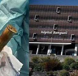 ஆசன வாயில் வெடிகுண்டுடன் வந்த நபர்..பயத்தில் அலறி அடித்து ஓடிய நோயாளிகள்