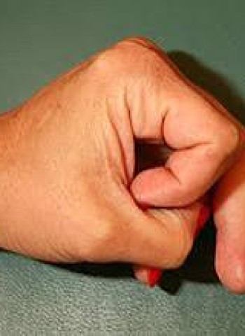 விரல் முறிந்த கவிஞன்