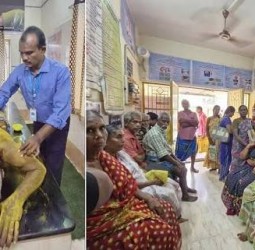 பக்கவாத நோயாளிக்கு வி.எஸ். மருத்துவமனையில் நவீன காந்த அலை சிகிச்சை அறிமுகம்