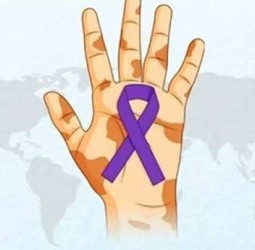 தொழுநோய் ஒழிப்போம்